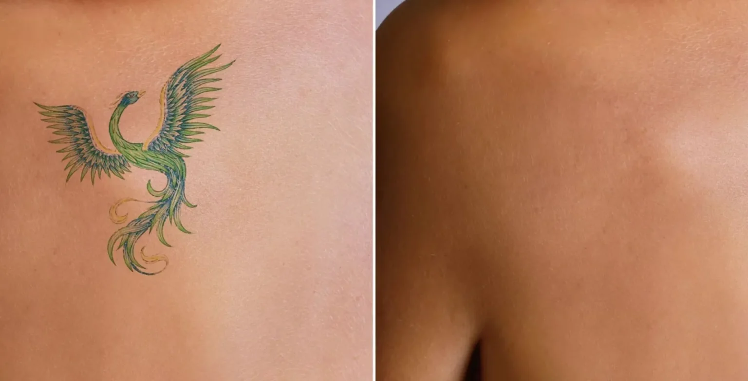 guide to skin renewal effective techniques for a fresh start