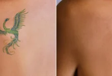 guide to skin renewal effective techniques for a fresh start