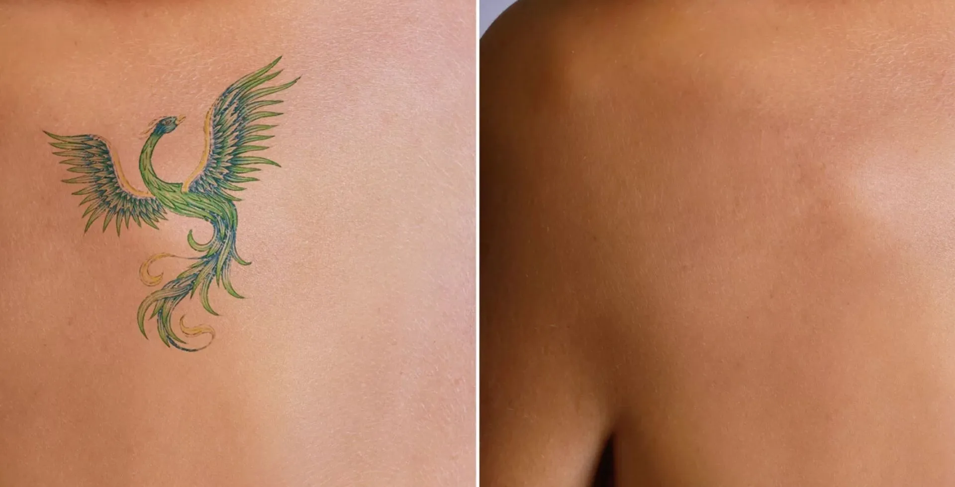guide to skin renewal effective techniques for a fresh start