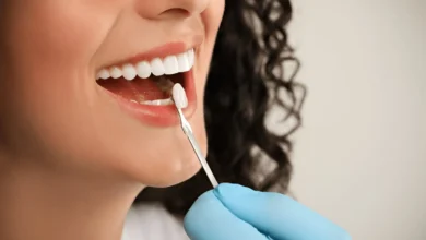 the true cost of veneers investing in your smile