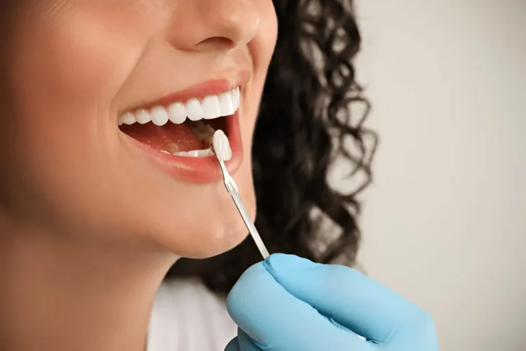 the true cost of veneers investing in your smile