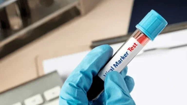 understanding viral marker test in india complete guide for smart health decisions
